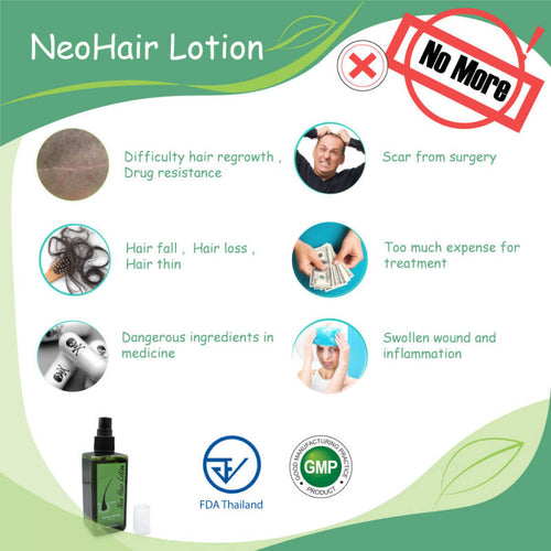 Neo Hair Lotion | Hair Growth (120 ml) - Anti Hair Loss Formula